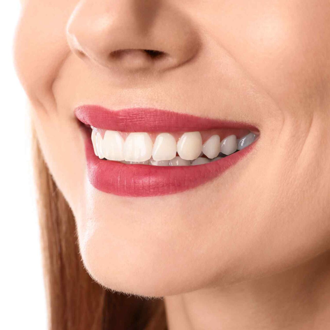 https://www.bhartidental.in/wp-content/uploads/2020/03/service_whitening-1280x1280.jpg